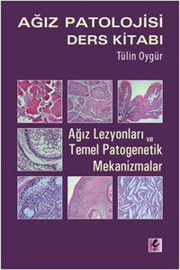 Efil Ağız Patolojisi Ders Kitabı - Tülin Oygür %10 indirimli Tülin Oyg