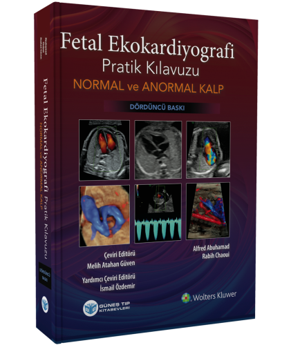 Fetal Ekokardiyografi Pratik Kılavuzu Normal ve Anormal Kalp Alfred Ab