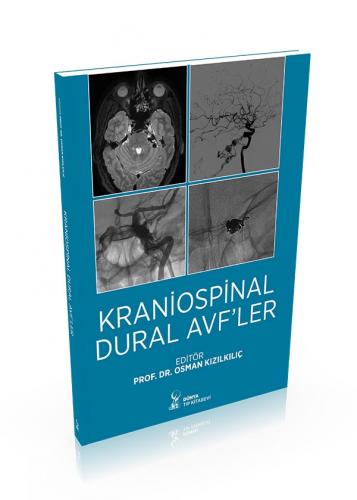 Kraniospinal Dural AVF’ler Osman Kızılkılıç