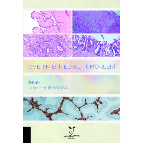 Overin Epitelyal Tümörleri İsmail Harmankaya