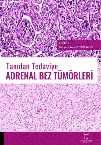 Tanıdan Tedaviye Adrenal Bez Tümörleri Meryem İlkay EREN KARANİS